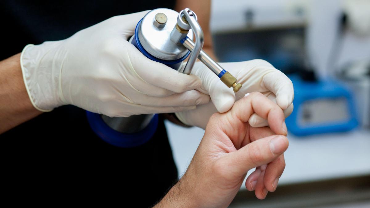 Cryosurgery