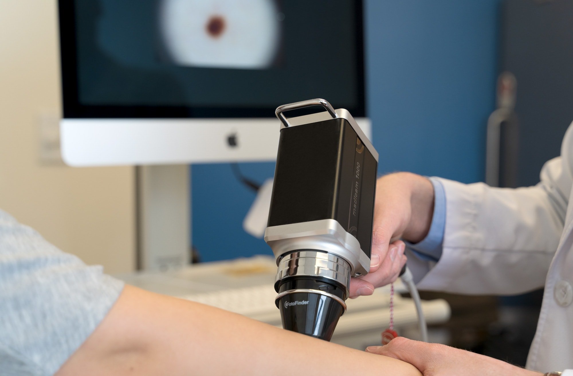 Inspection with Fotofinder (Non-invasive)