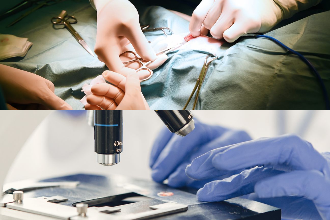 Mohs Surgery